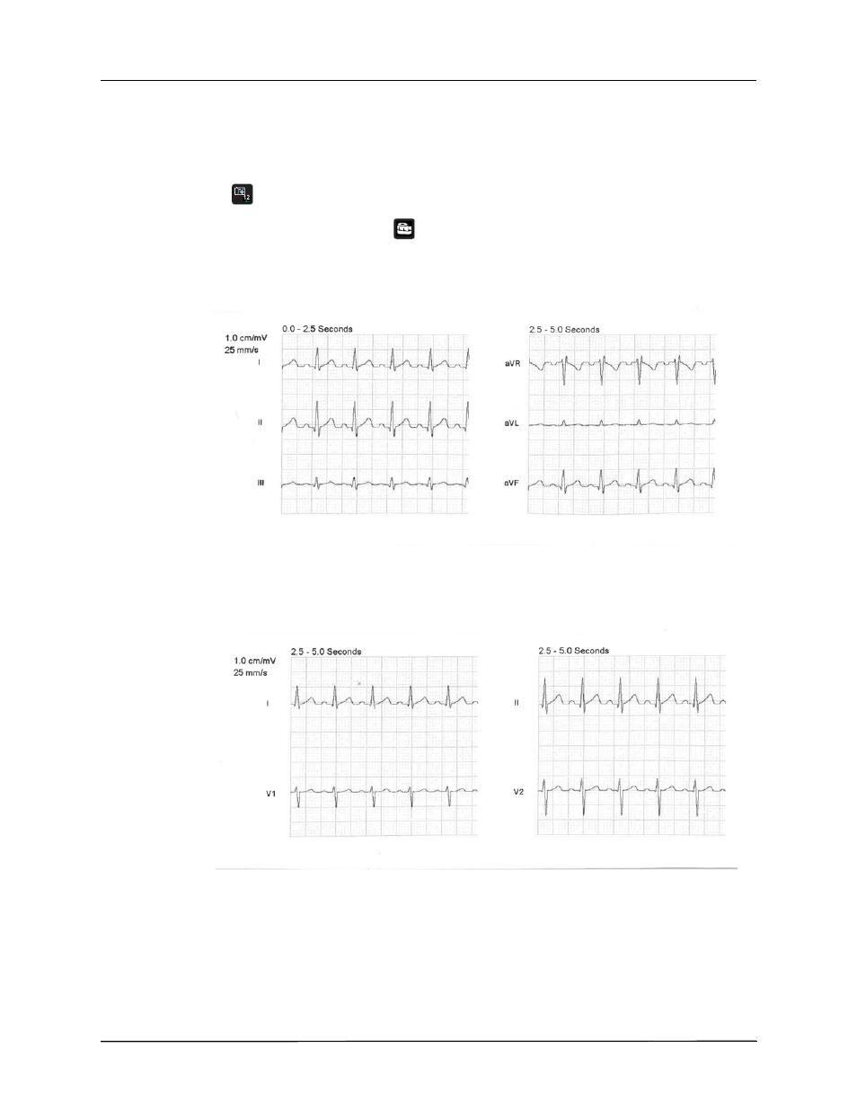 Printing 12-lead waveform traces | ZOLL X Series Monitor Defibrillator Rev H User Manual | Page 186 / 328