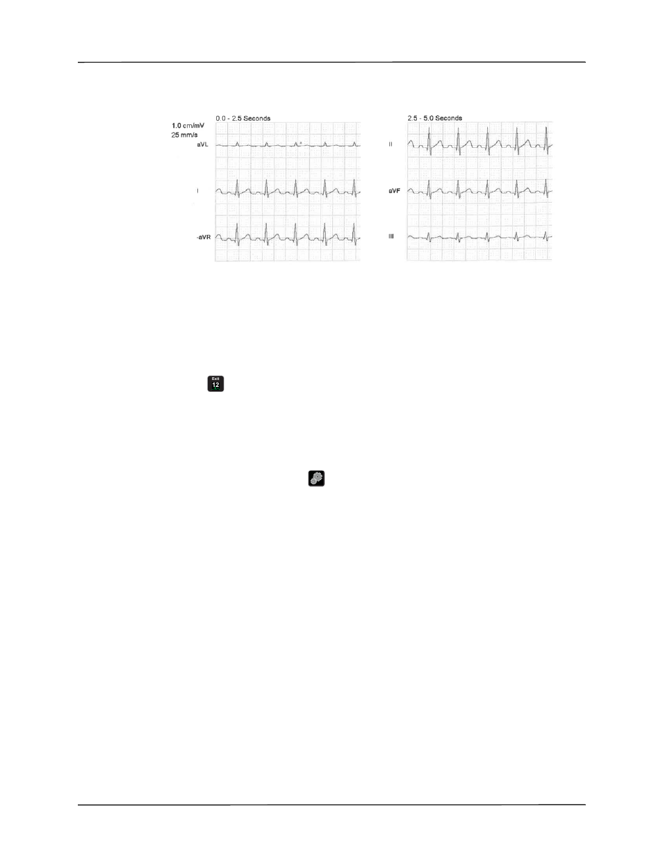 Lead print and display options | ZOLL X Series Monitor Defibrillator Rev H User Manual | Page 187 / 328