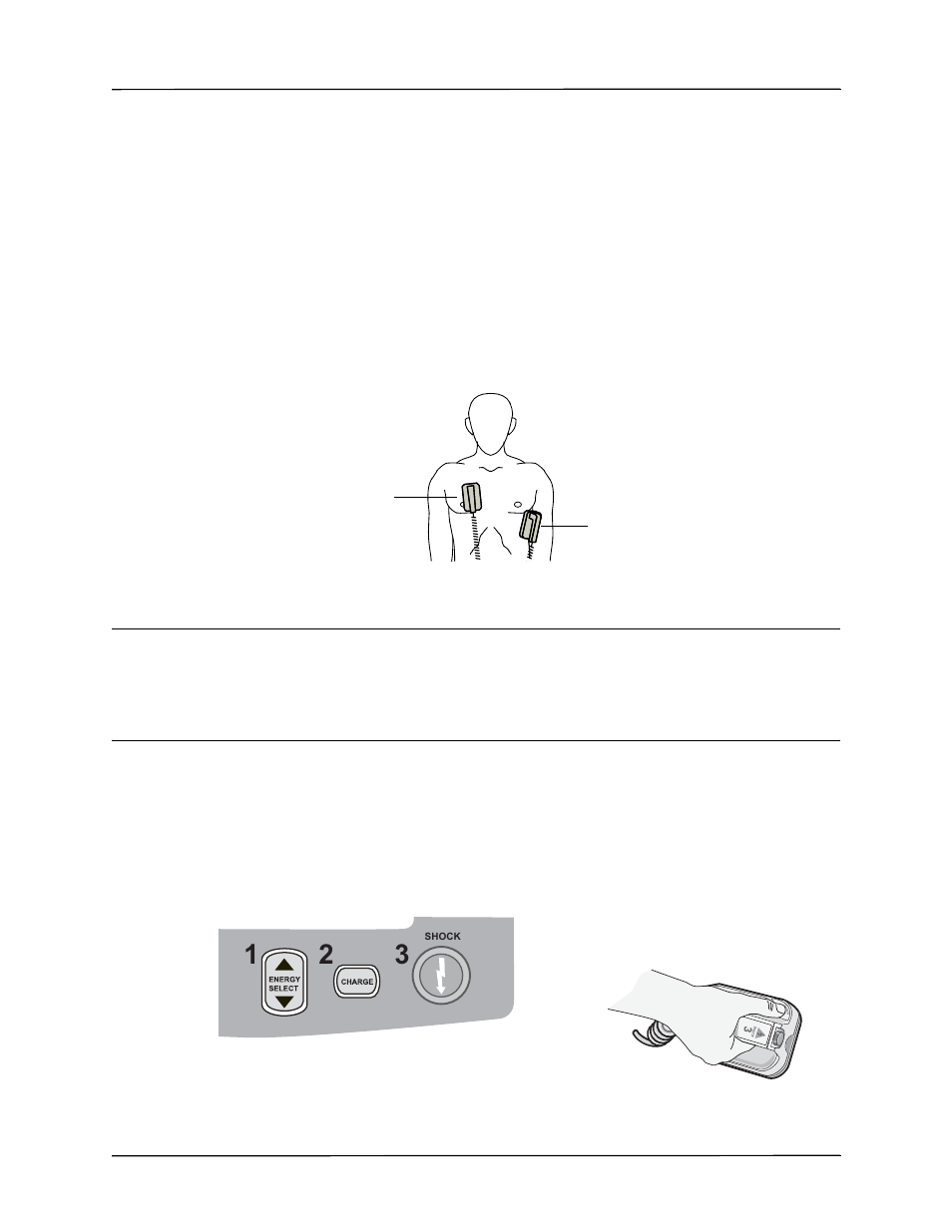 2 charge defibrillator | ZOLL X Series Monitor Defibrillator Rev H User Manual | Page 193 / 328