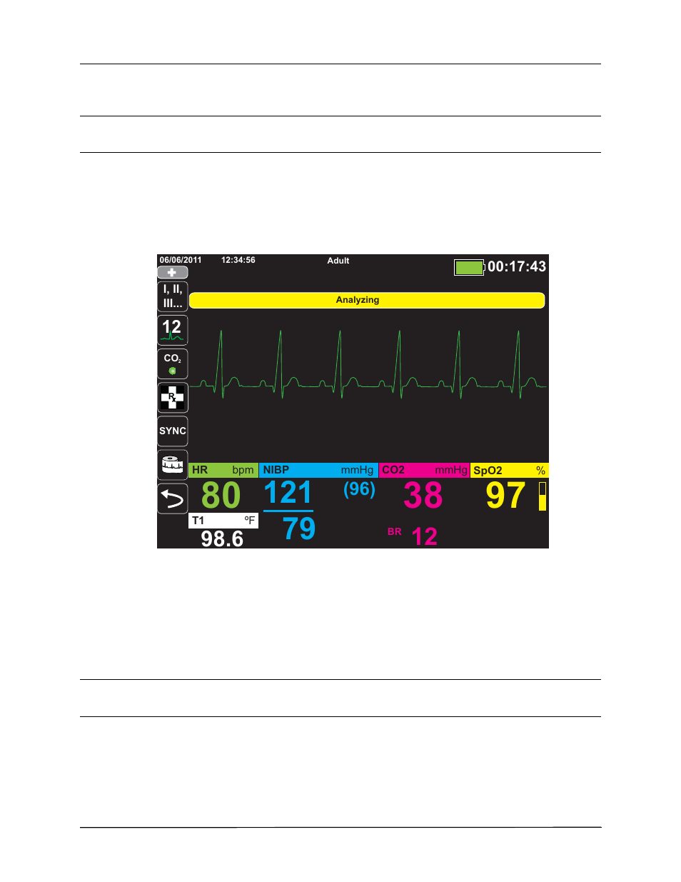 ZOLL X Series Monitor Defibrillator Rev H User Manual | Page 208 / 328