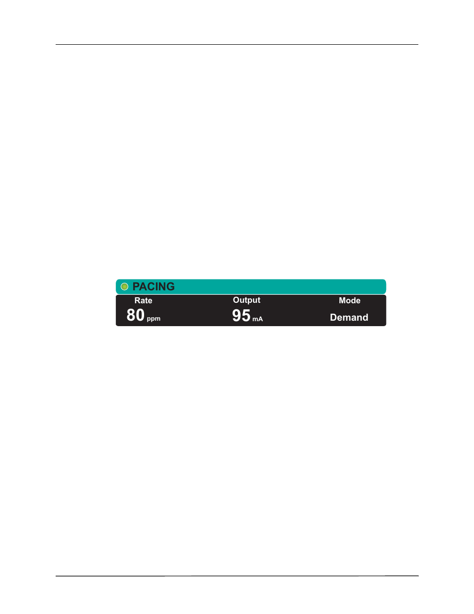 Pacing, 4 set mode, 5 set pacer rate | 6 turn on pacer, 7 set pacer output, 8 determine capture | ZOLL X Series Monitor Defibrillator Rev H User Manual | Page 220 / 328