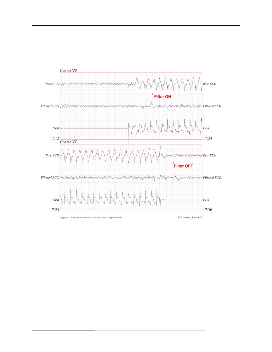 ZOLL X Series Monitor Defibrillator Rev H User Manual | Page 236 / 328