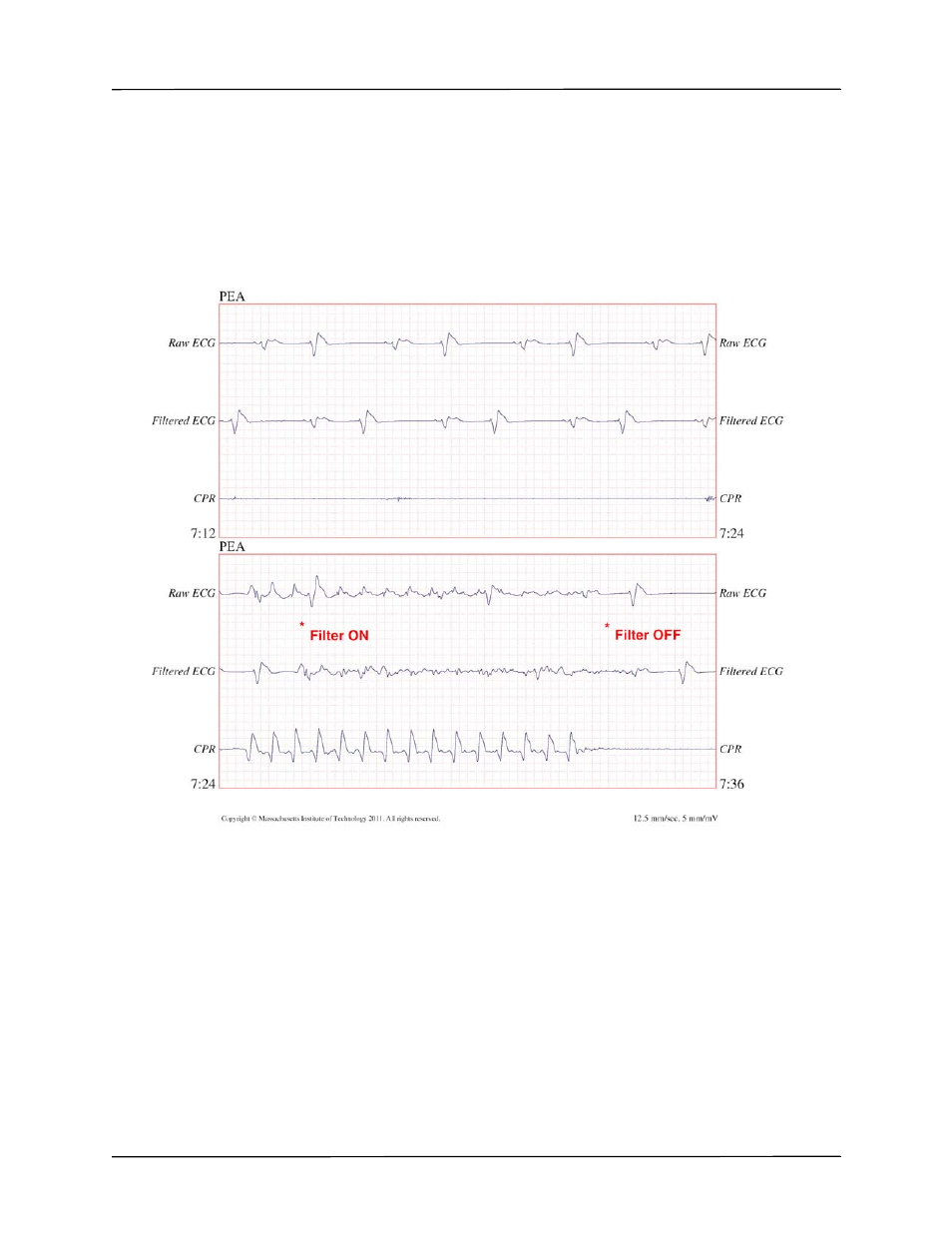 ZOLL X Series Monitor Defibrillator Rev H User Manual | Page 237 / 328