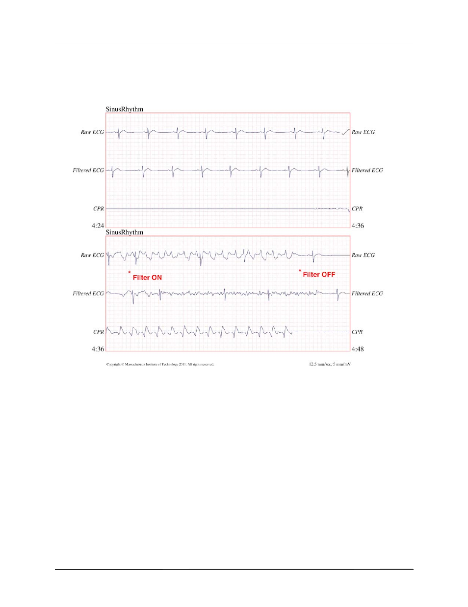 ZOLL X Series Monitor Defibrillator Rev H User Manual | Page 238 / 328