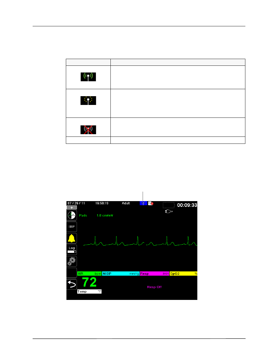 The wireless icon | ZOLL X Series Monitor Defibrillator Rev H User Manual | Page 246 / 328