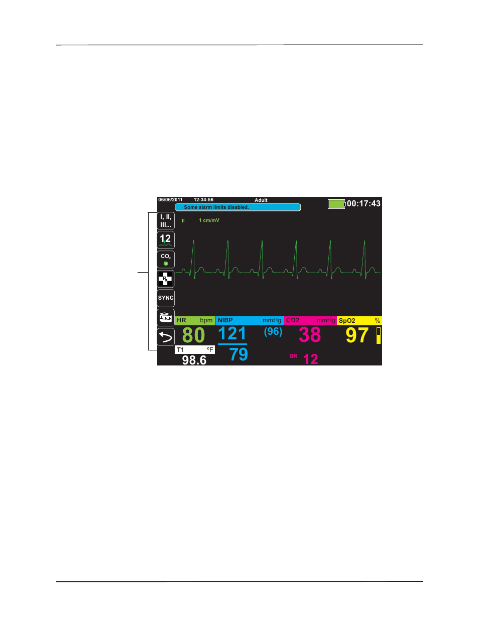 ZOLL X Series Monitor Defibrillator Rev H User Manual | Page 45 / 328