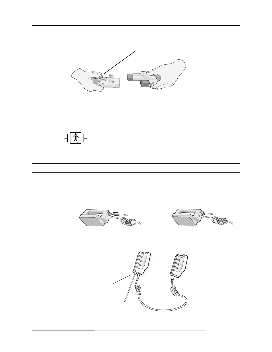 External paddles | ZOLL X Series Monitor Defibrillator Rev H User Manual | Page 50 / 328