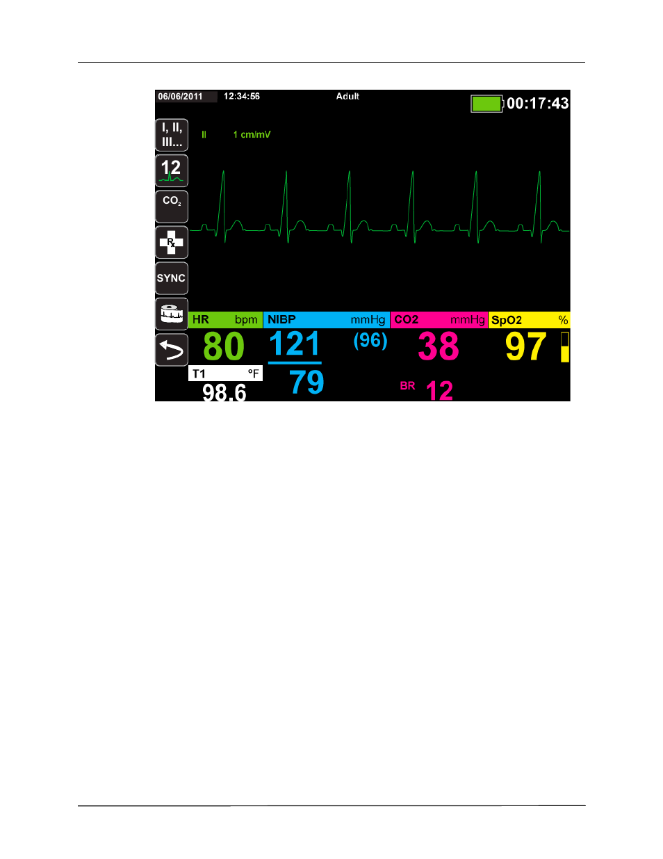 ZOLL X Series Monitor Defibrillator Rev H User Manual | Page 66 / 328