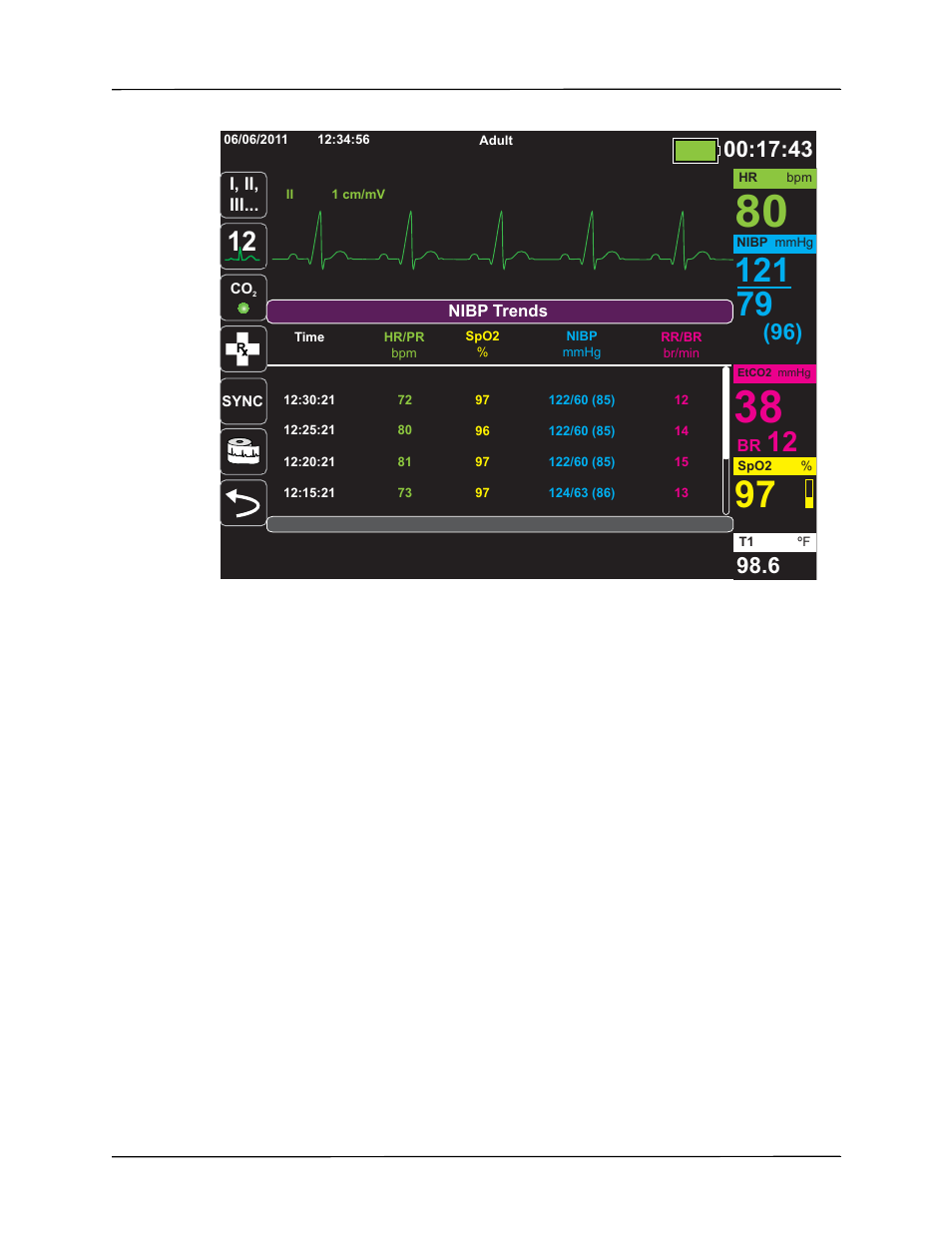 ZOLL X Series Monitor Defibrillator Rev H User Manual | Page 67 / 328