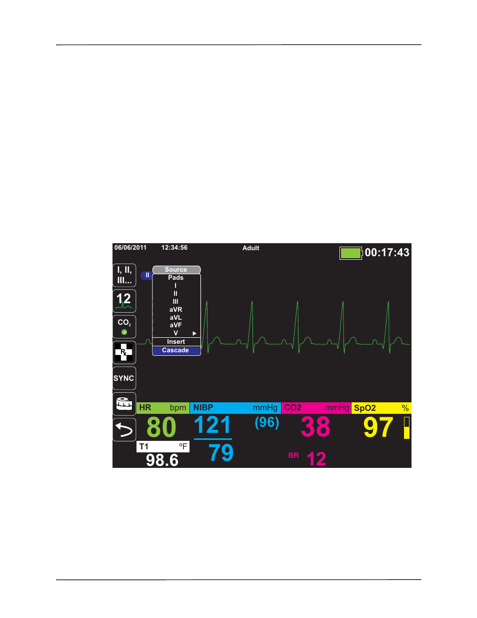 Configuring the waveform display | ZOLL X Series Monitor Defibrillator Rev H User Manual | Page 69 / 328