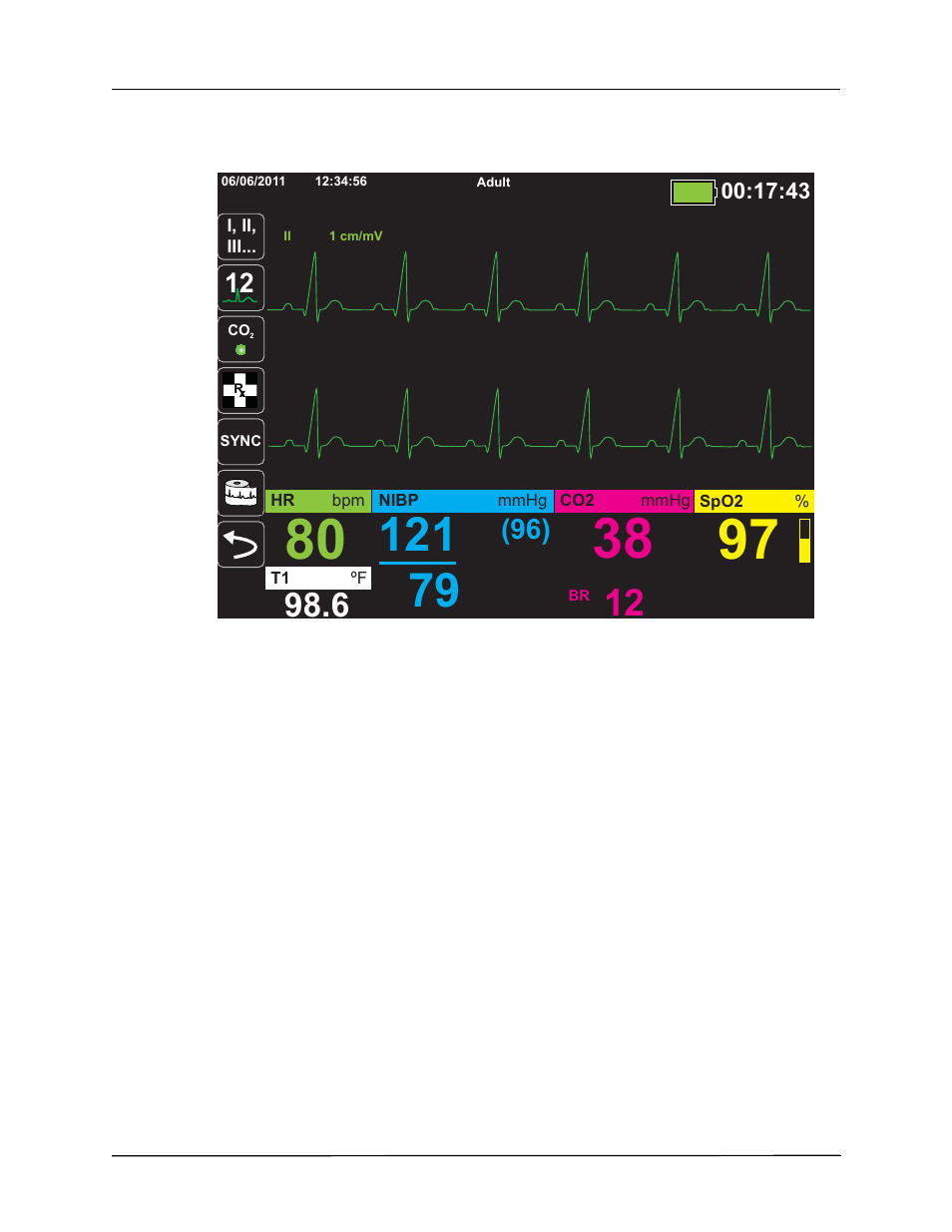 ZOLL X Series Monitor Defibrillator Rev H User Manual | Page 70 / 328