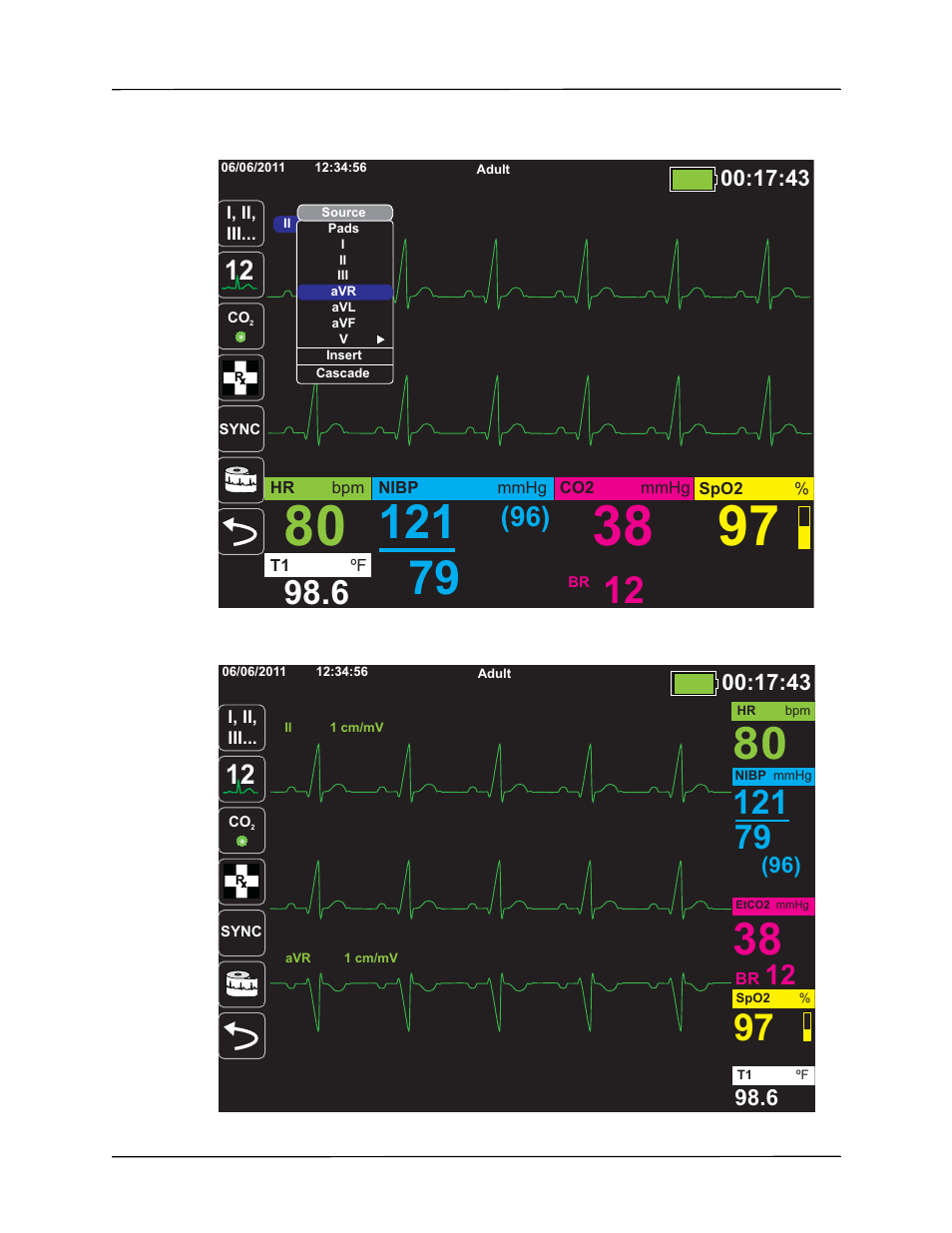 ZOLL X Series Monitor Defibrillator Rev H User Manual | Page 71 / 328