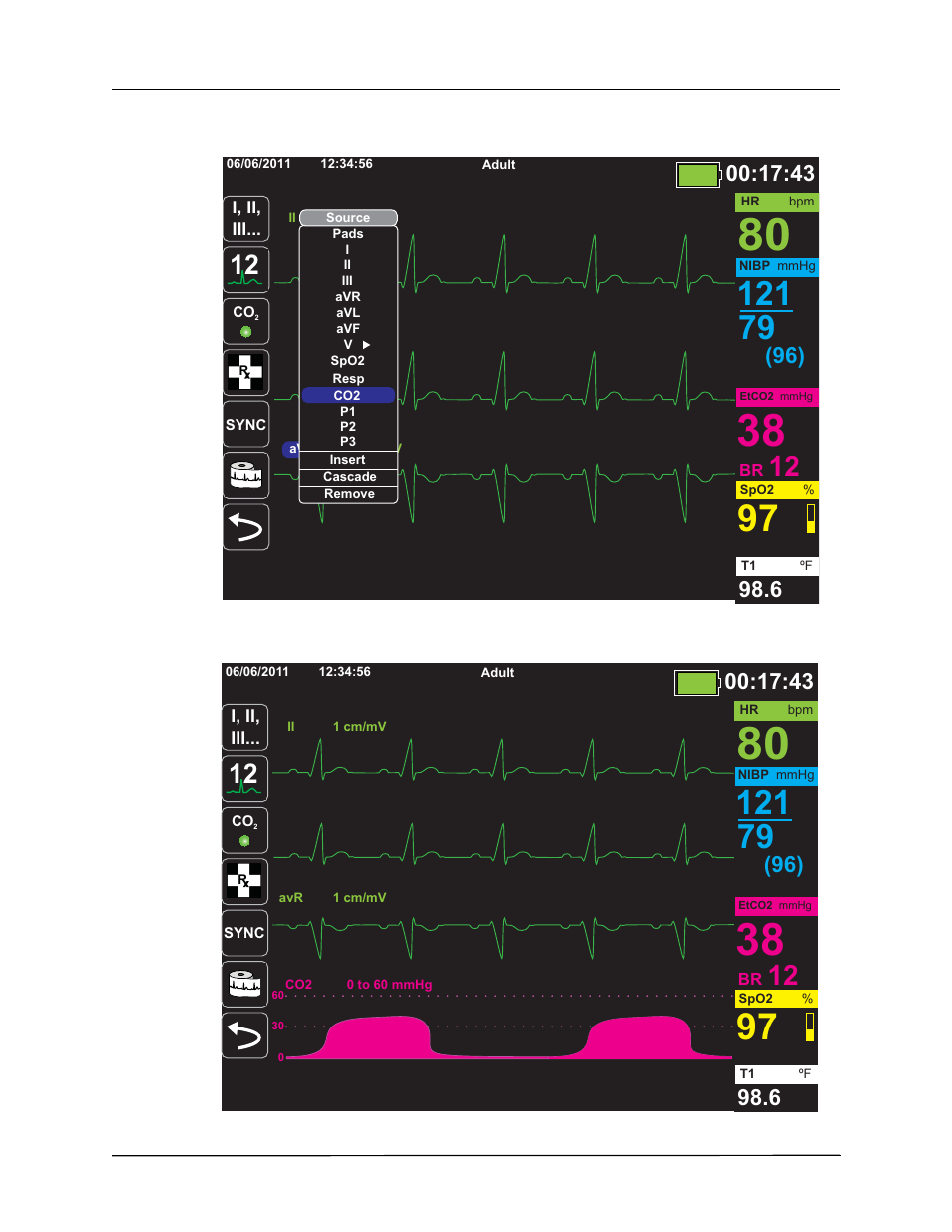 ZOLL X Series Monitor Defibrillator Rev H User Manual | Page 72 / 328