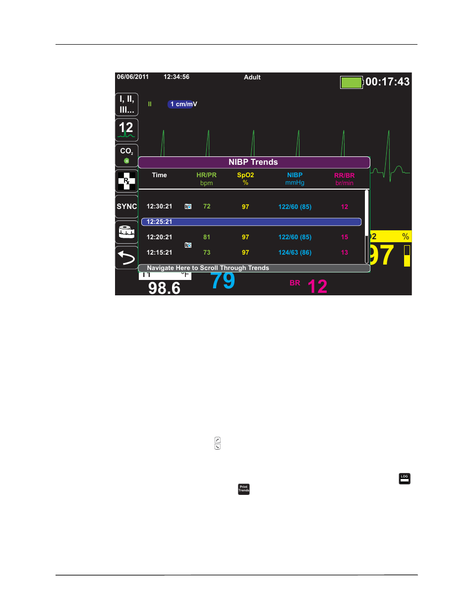 Displaying and printing trend information | ZOLL X Series Monitor Defibrillator Rev H User Manual | Page 74 / 328