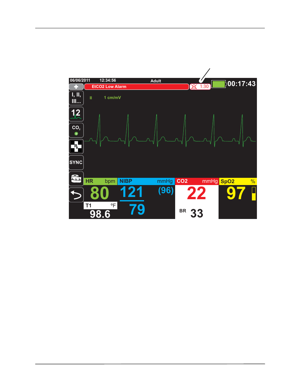 ZOLL X Series Monitor Defibrillator Rev H User Manual | Page 82 / 328