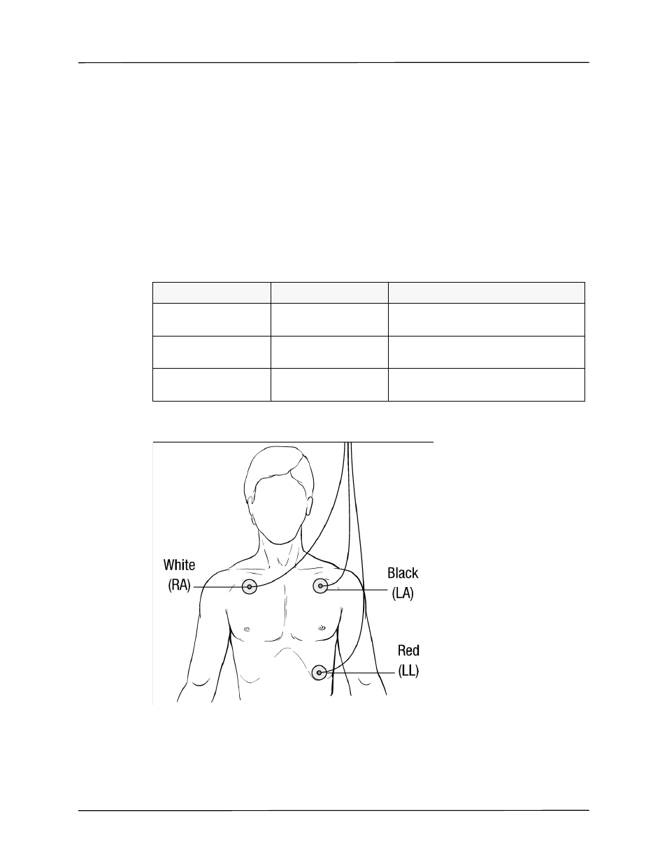 Applying electrodes to the patient | ZOLL X Series Monitor Defibrillator Rev H User Manual | Page 89 / 328