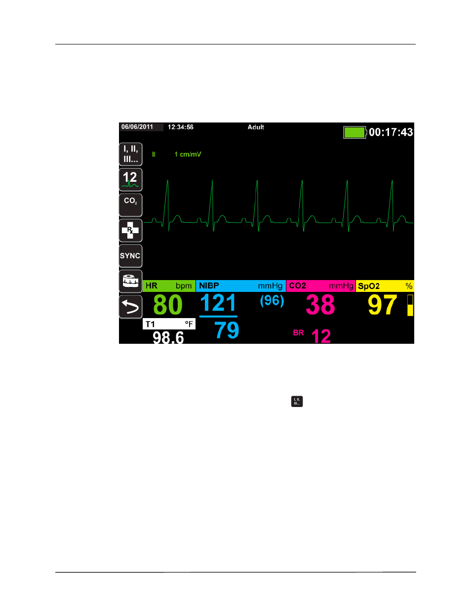 Selecting ecg waveforms for display | ZOLL X Series Monitor Defibrillator Rev H User Manual | Page 92 / 328