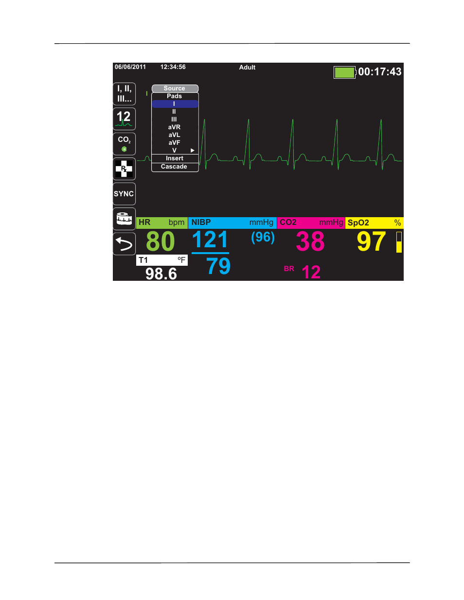 ZOLL X Series Monitor Defibrillator Rev H User Manual | Page 93 / 328