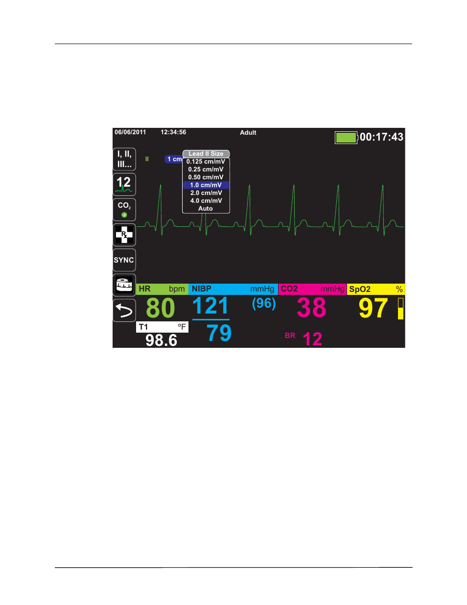 ZOLL X Series Monitor Defibrillator Rev H User Manual | Page 94 / 328