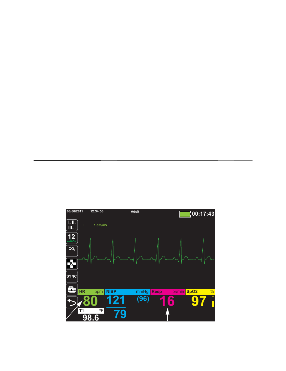 Chapter 7, Monitoring respiration (resp) and heart rate (hr) | ZOLL X Series Monitor Defibrillator Rev H User Manual | Page 97 / 328