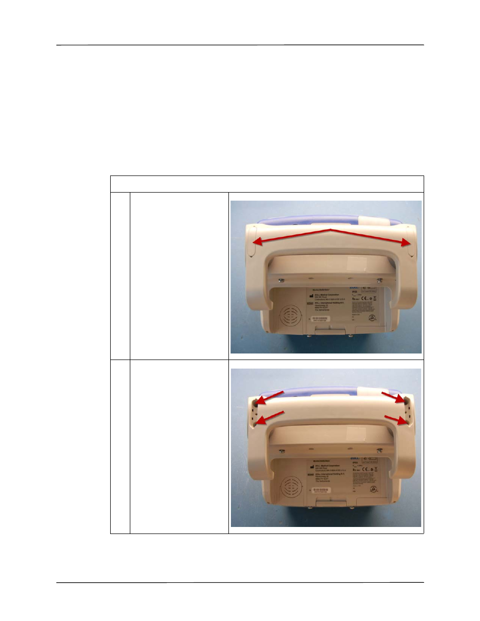 Removing the handle | ZOLL X Series Monitor Defibrillator Rev D User Manual | Page 69 / 144