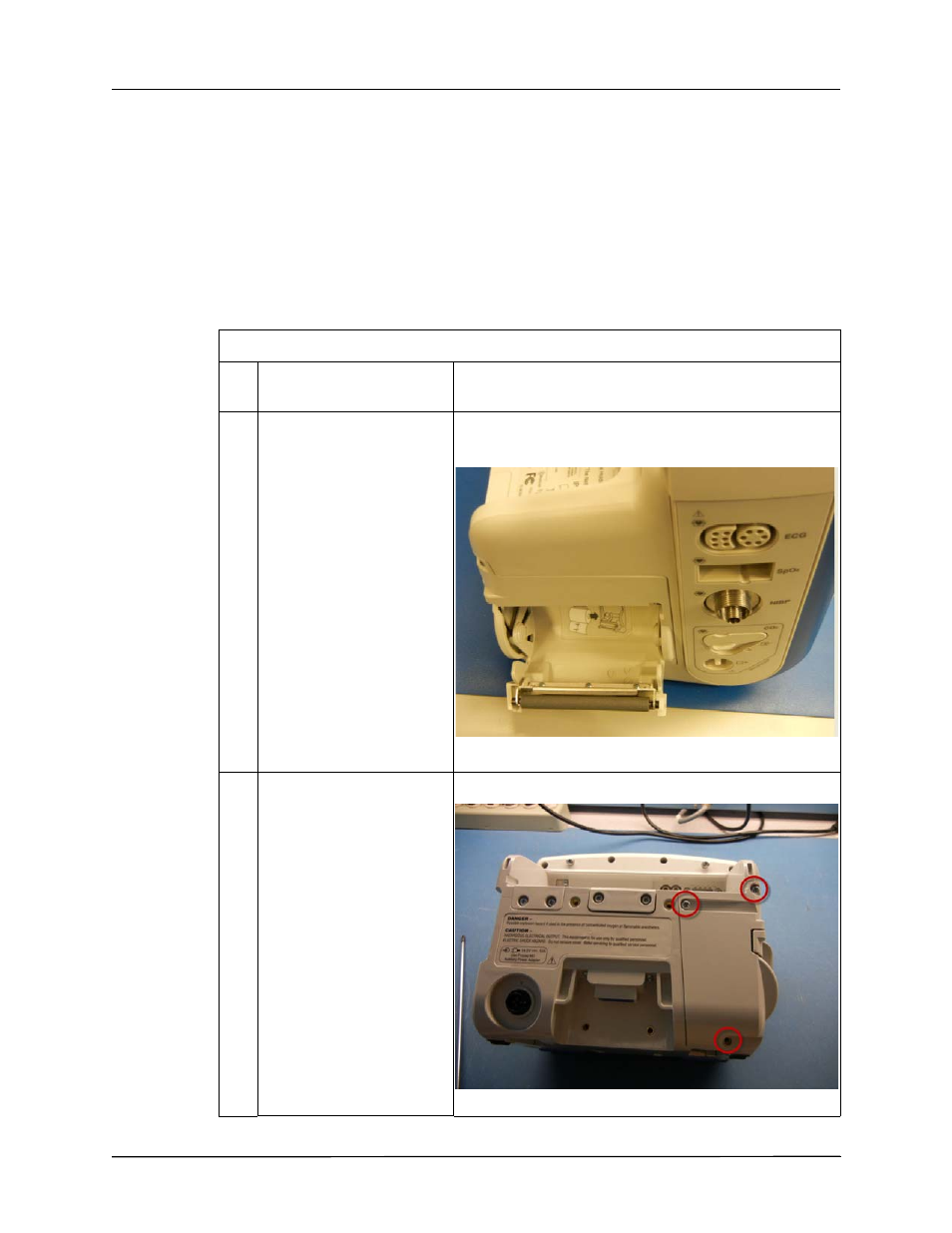 Removing the printer module | ZOLL X Series Monitor Defibrillator Rev D User Manual | Page 70 / 144