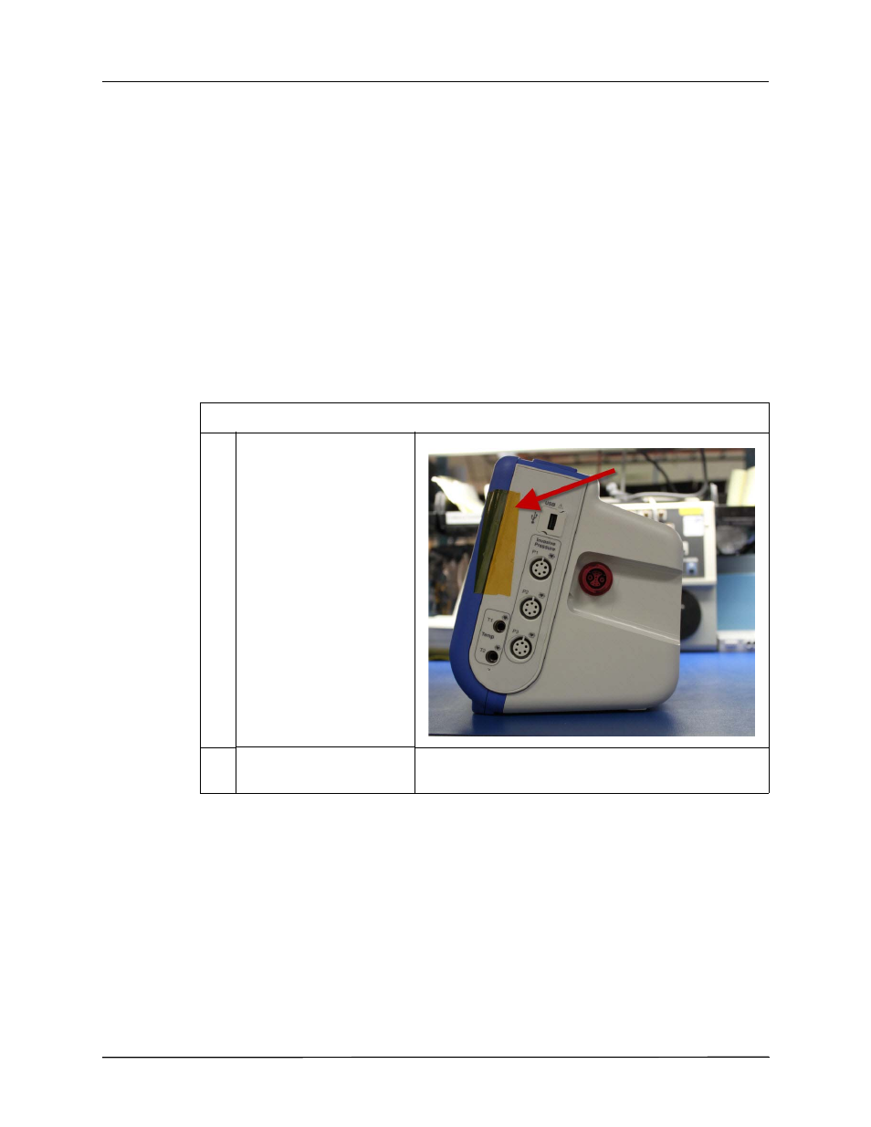 Disassembling the main unit | ZOLL X Series Monitor Defibrillator Rev D User Manual | Page 72 / 144