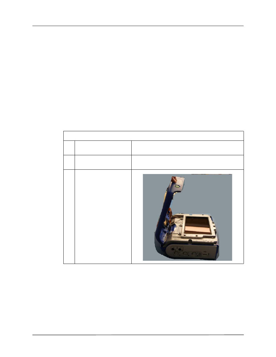 Removing the front enclosure module | ZOLL X Series Monitor Defibrillator Rev D User Manual | Page 76 / 144