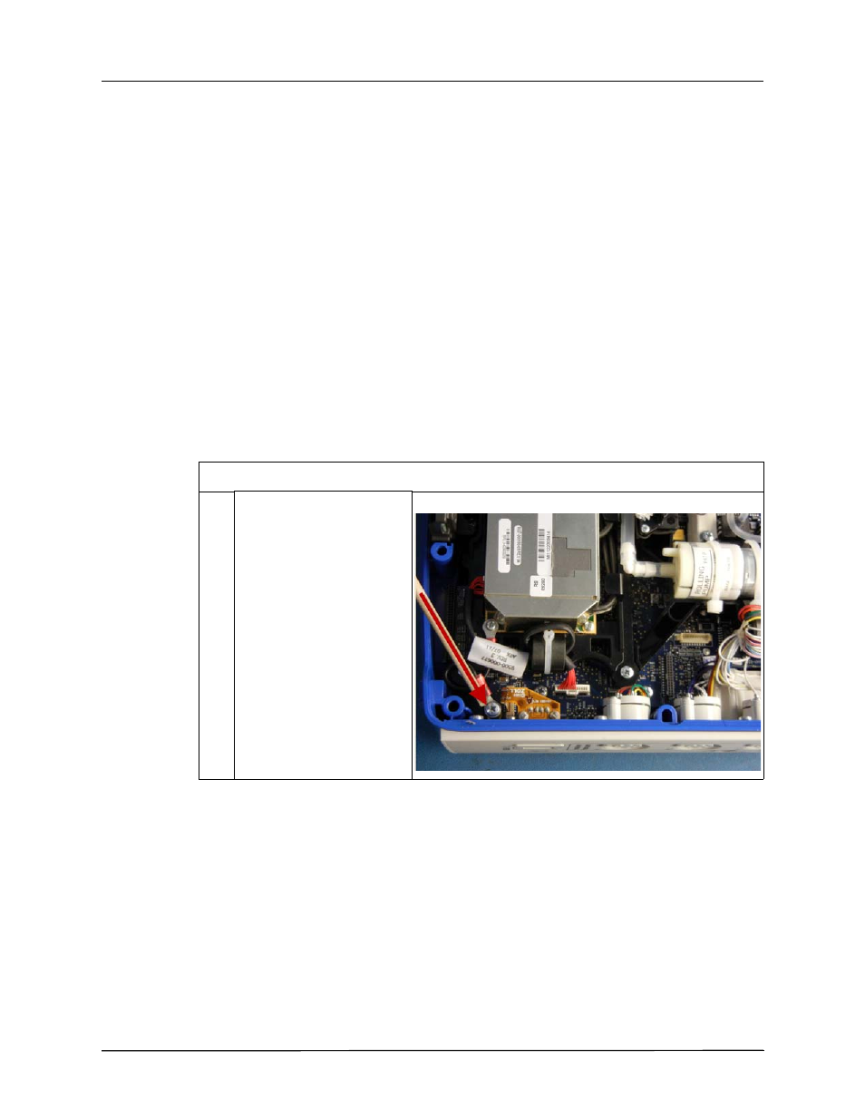 Removing the display module | ZOLL X Series Monitor Defibrillator Rev D User Manual | Page 78 / 144