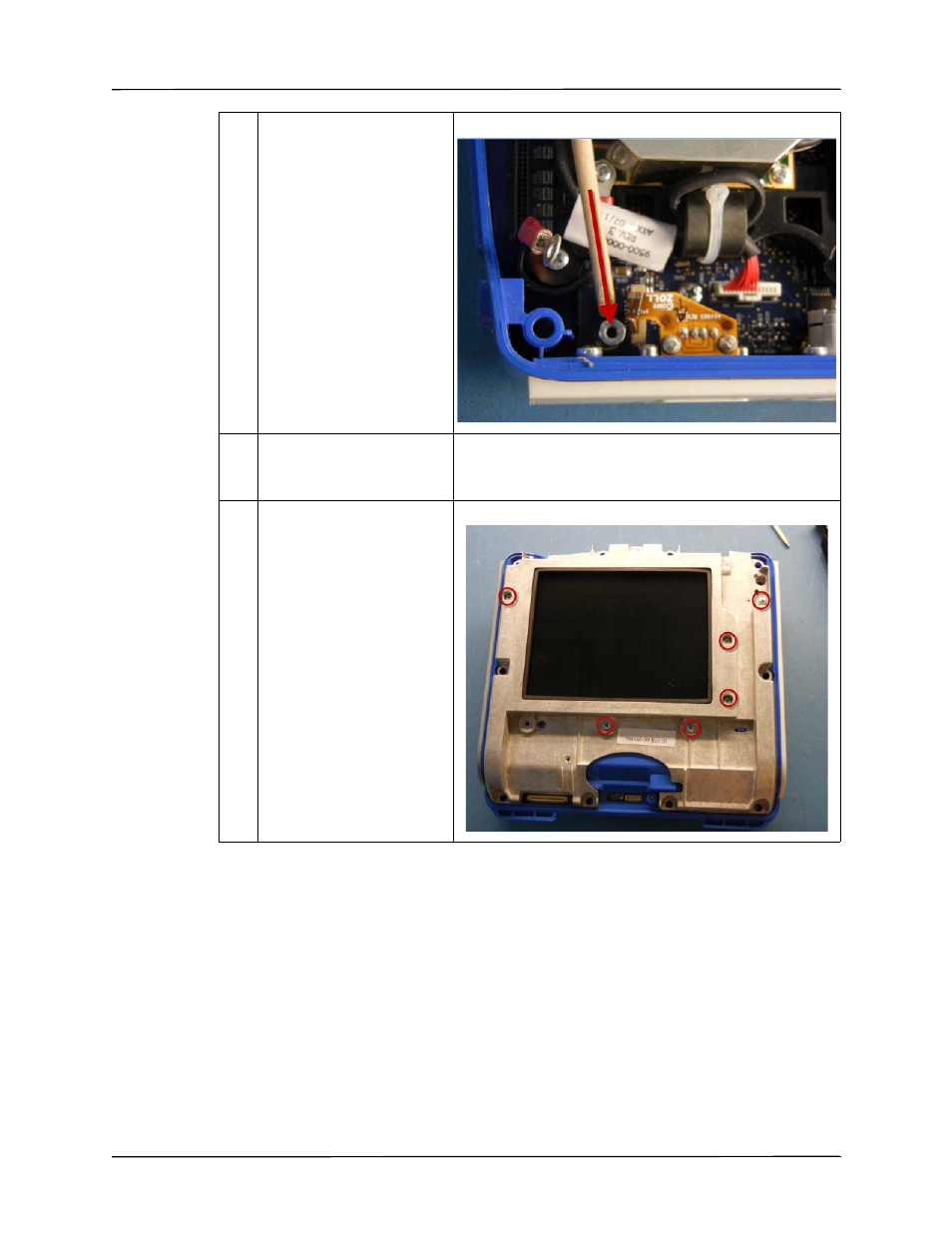 ZOLL X Series Monitor Defibrillator Rev D User Manual | Page 79 / 144