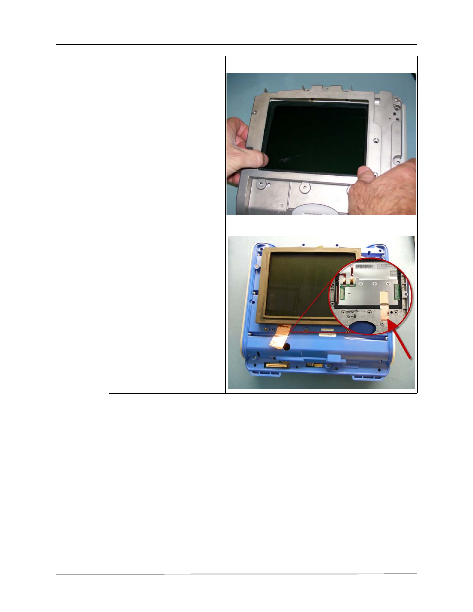 ZOLL X Series Monitor Defibrillator Rev D User Manual | Page 80 / 144