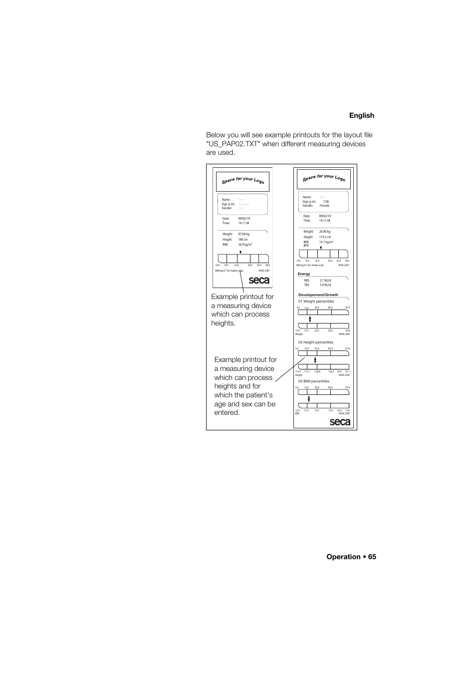 Seca 466 User Manual | Page 65 / 268