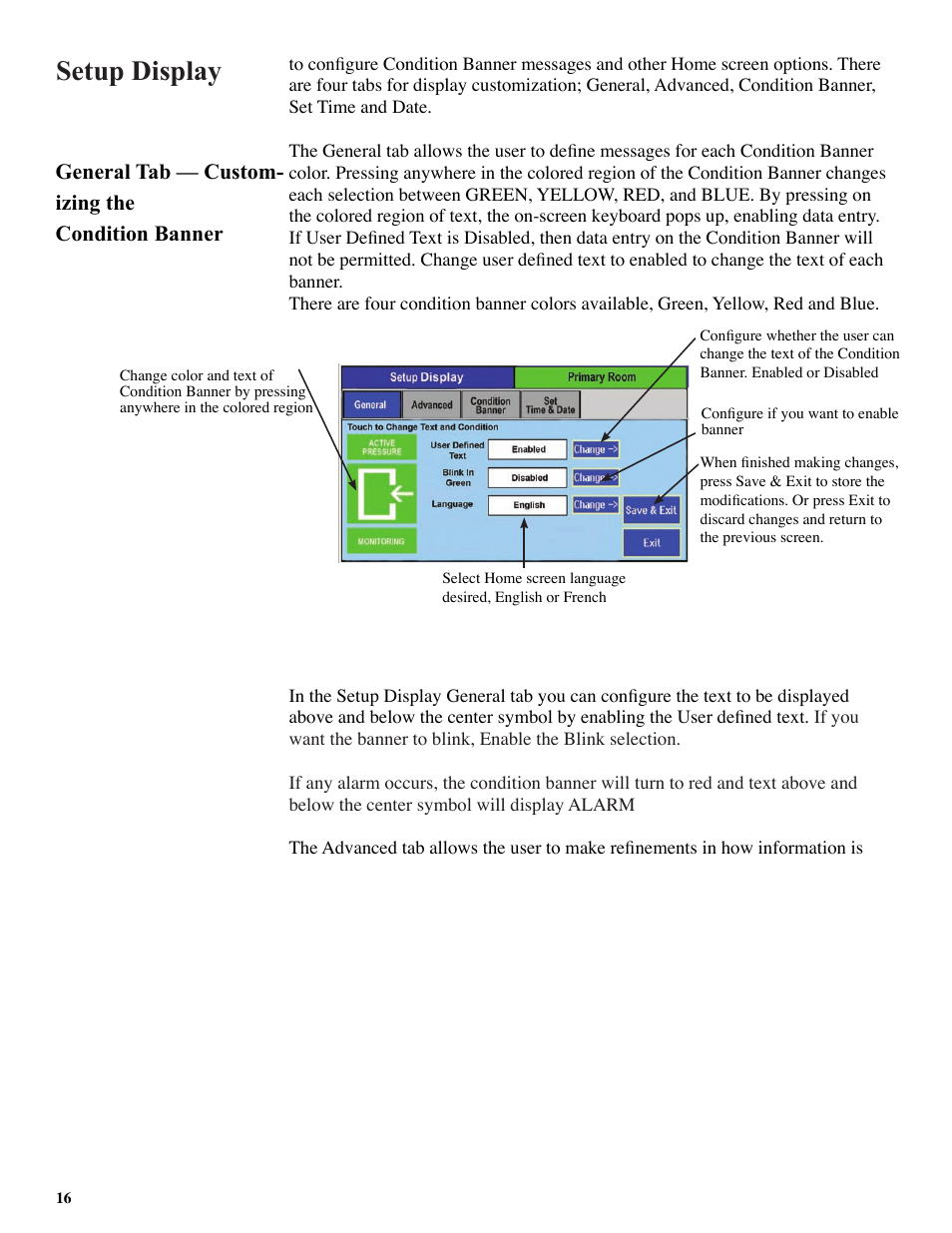 Setup display, General tab — custom- izing the condition banner | Setra System SRCM User Manual | Page 16 / 43
