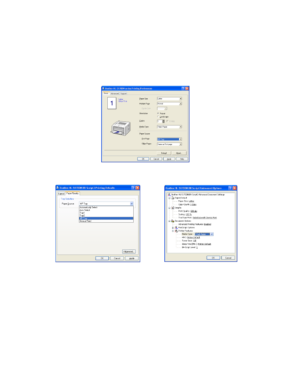 For hl-5150d and hl-5170dn) -20 | Brother HL-5150D User Manual | Page 27 / 143