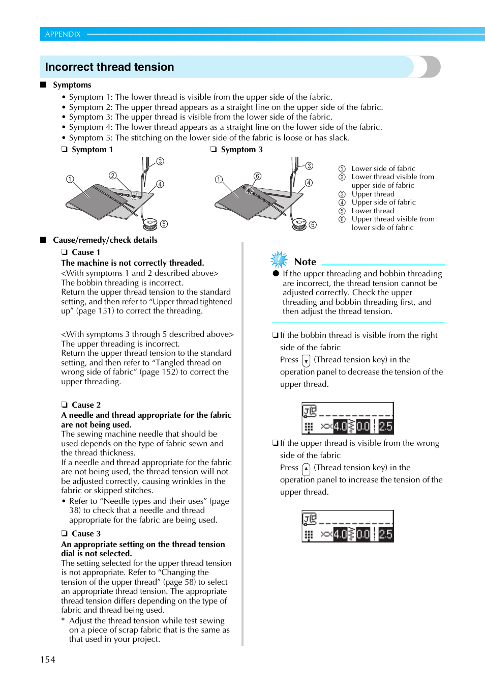 Incorrect thread tension | Brother NX-800 User Manual | Page 156 / 176