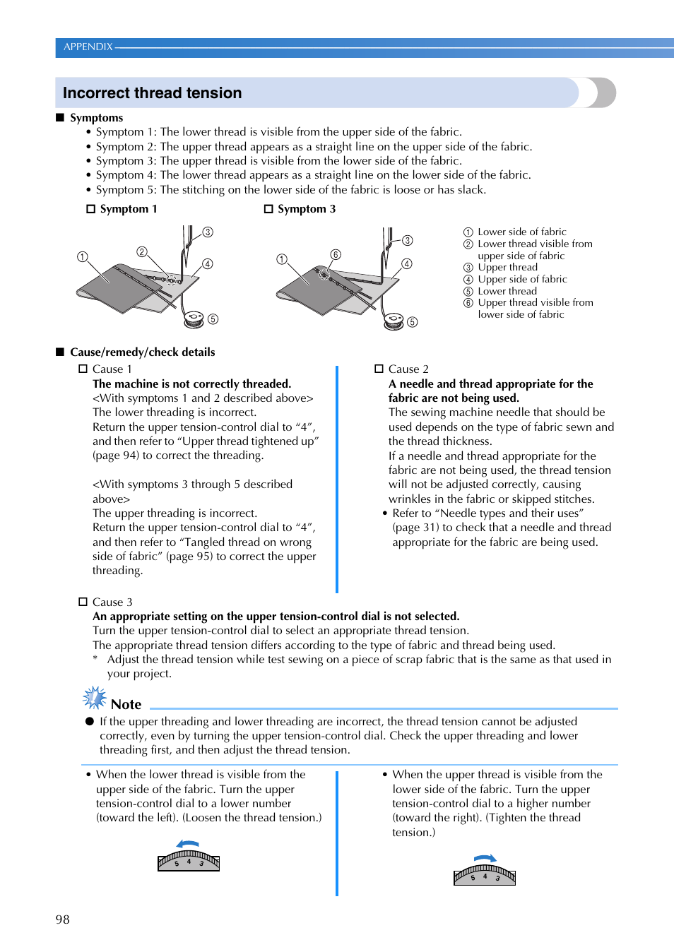 Incorrect thread tension | Brother SQ9185 User Manual | Page 100 / 116