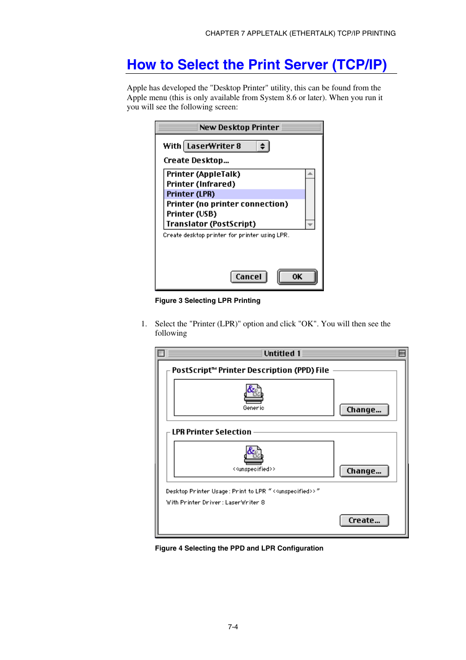 How to select the print server (tcp/ip) | Brother HL-1870N User Manual | Page 86 / 149