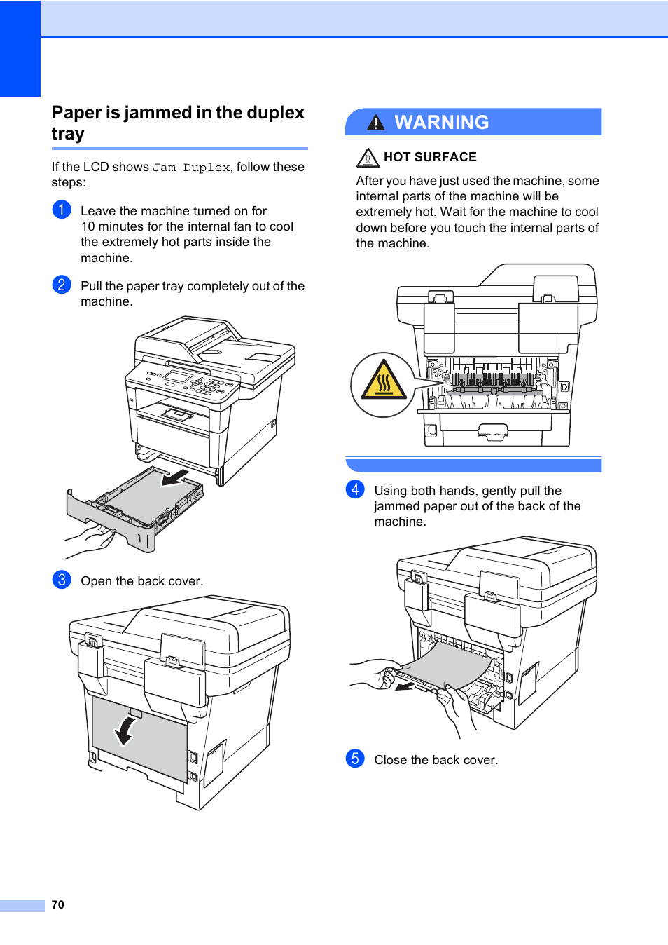 Paper is jammed in the duplex tray, Paper is jammed in the duplex tray uu, Warning | Brother DCP-8110DN User Manual | Page 80 / 127