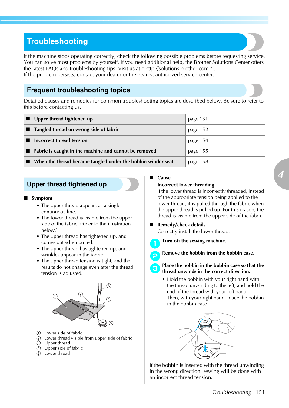 Troubleshooting, Frequent troubleshooting topics, Upper thread tightened up | Brother PC660LA User Manual | Page 153 / 176