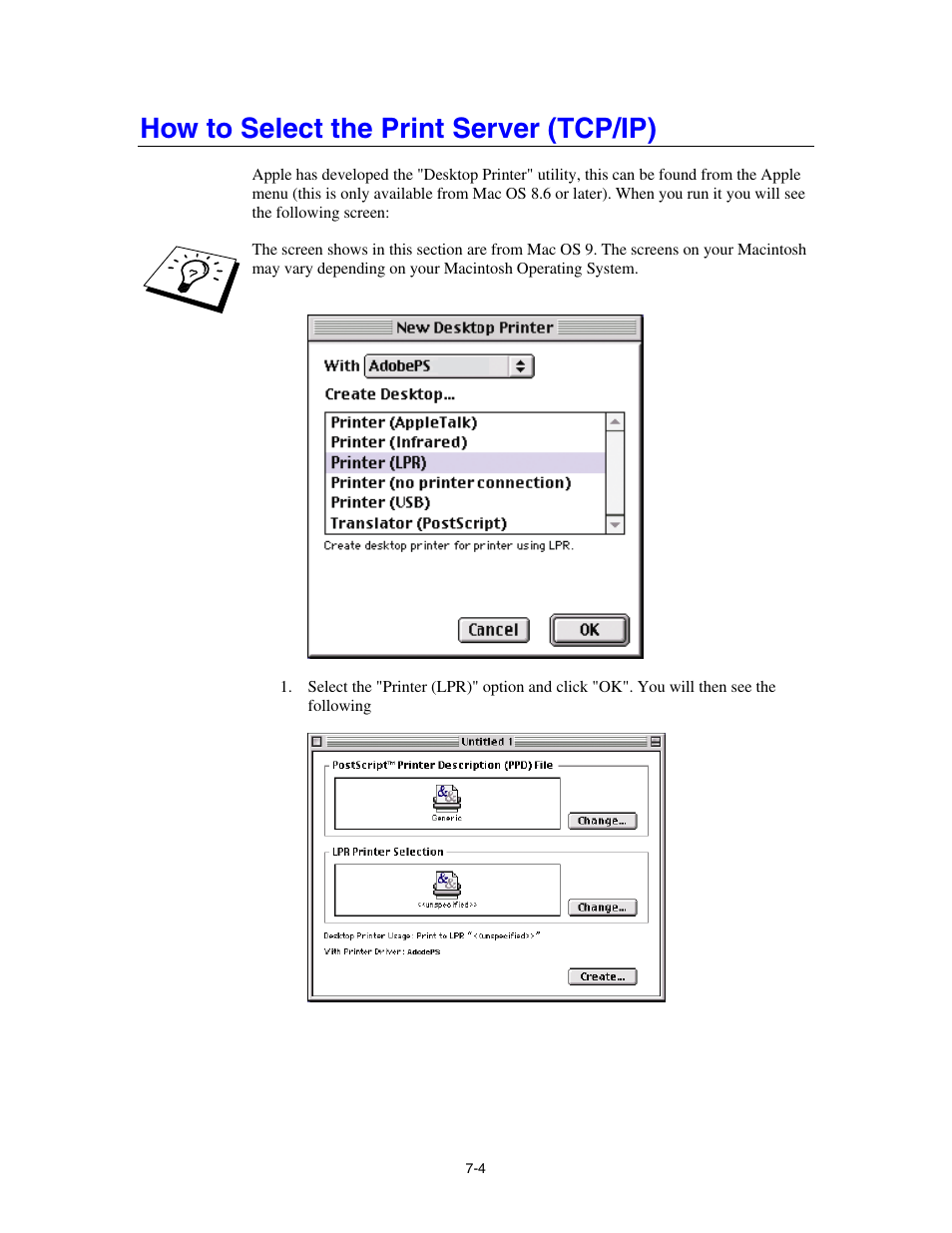 How to select the print server (tcp/ip) | Brother HL-4000CN User Manual | Page 59 / 78