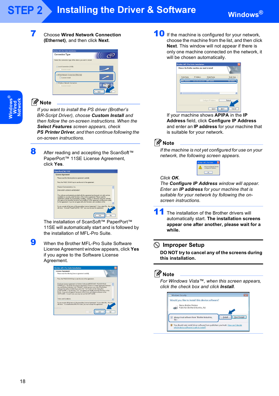 Step 2, Installing the driver & software, Windows | Improper setup | Brother MFC 9840CDW User Manual | Page 20 / 53
