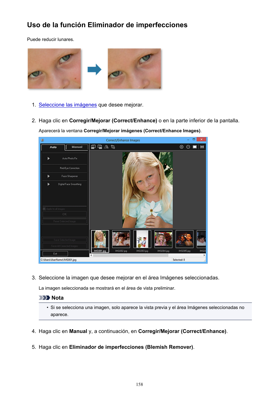Uso de la función eliminador de imperfecciones | Canon PIXMA PRO-1 User Manual | Page 158 / 320