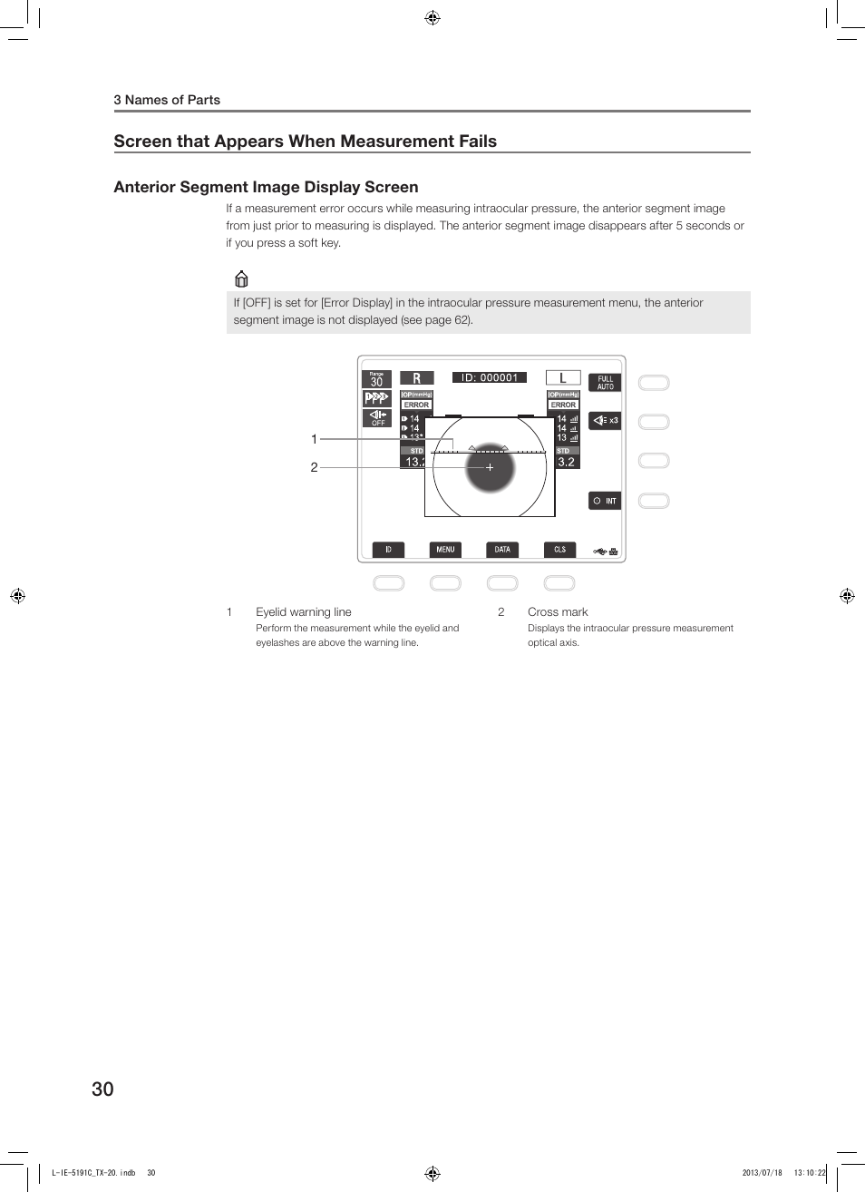 Screen that appears when measurement fails, Anterior segment image display screen | Canon TX-20 Full Auto Tonometer User Manual | Page 30 / 100