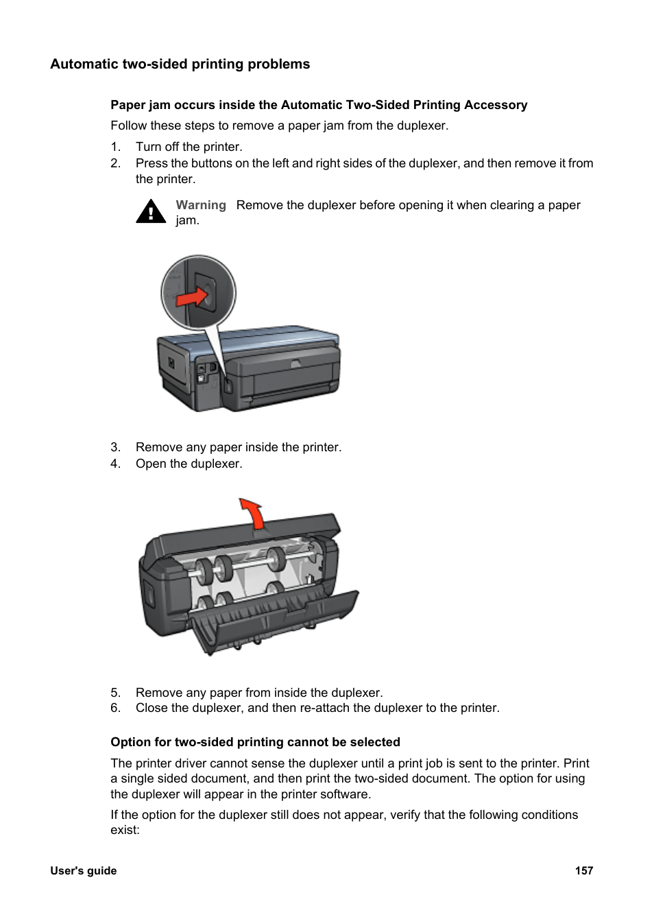 Automatic two-sided printing problems, Accessory | HP Deskjet 6988dt Printer User Manual | Page 159 / 182