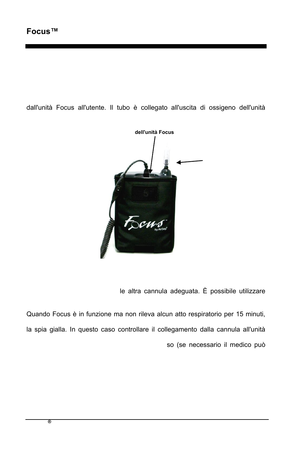 Focus™ it, Cannula nasale | AirSep MN172-1 User Manual | Page 255 / 502