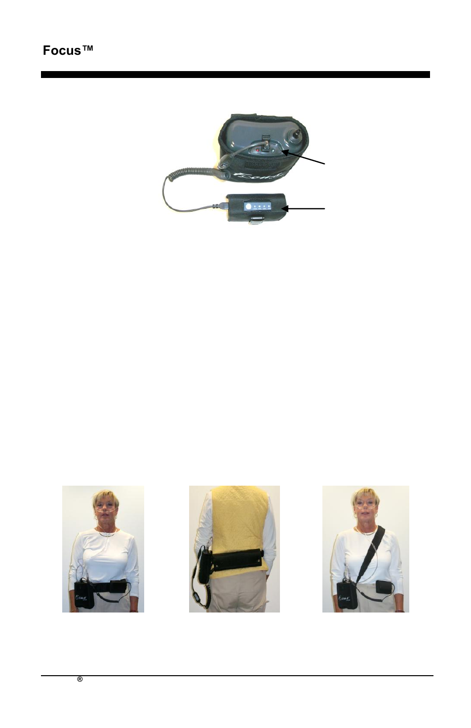 Focus™ nl | AirSep MN172-1 User Manual | Page 295 / 502