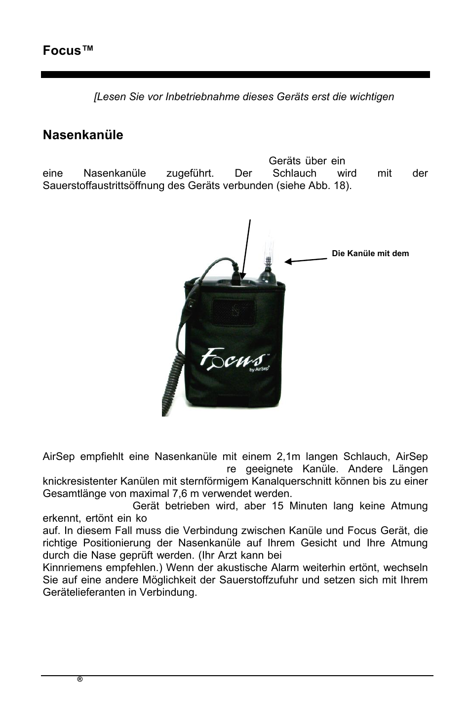 Focus™ de, Nasenkanüle | AirSep MN172-1 User Manual | Page 73 / 502