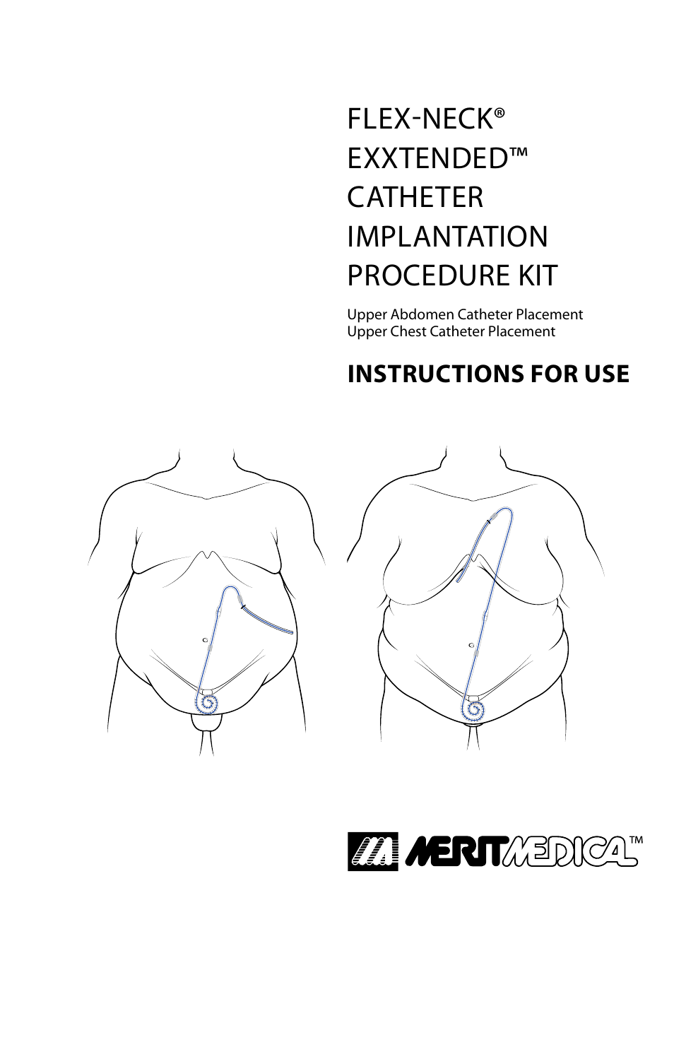 Merit Medical Flex-Neck ExxTended Catheter User Manual | 12 pages