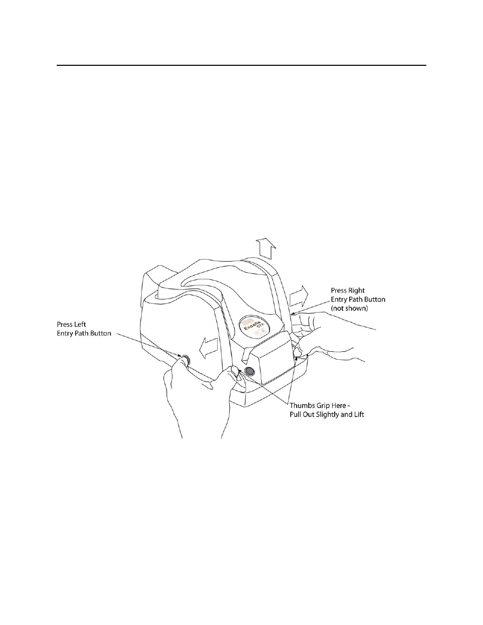 Outer cover removal | MagTek Excella STX99875342 User Manual | Page 14 / 47