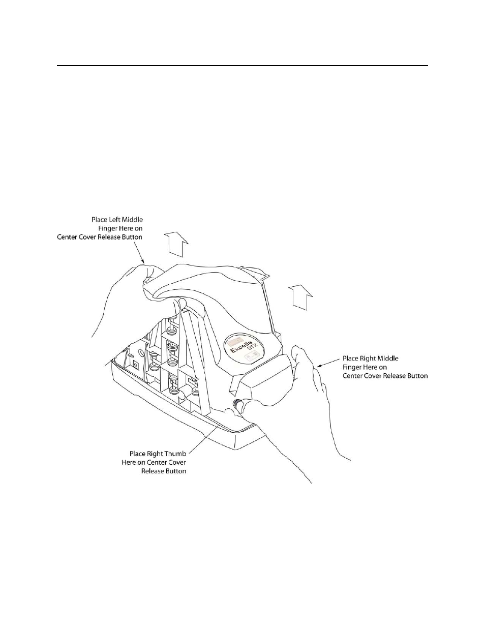 Center cover removal | MagTek Excella STX99875342 User Manual | Page 15 / 47